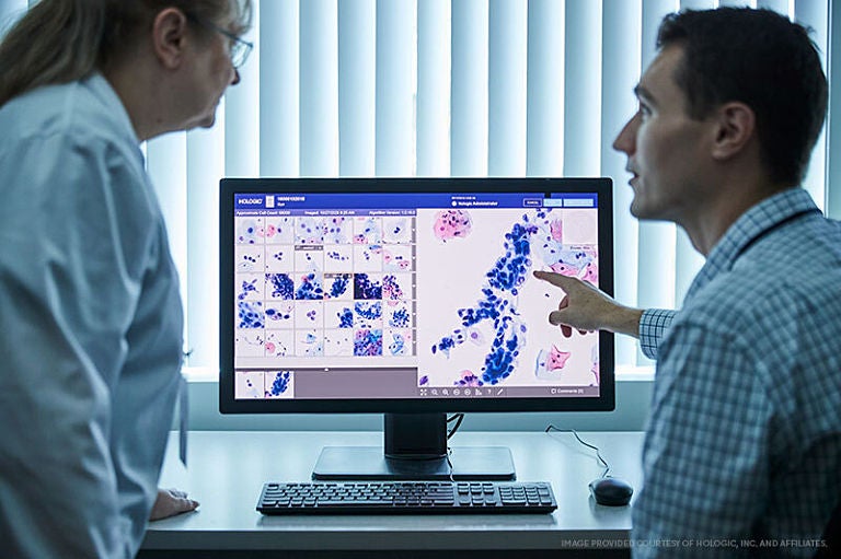 Story Hologic Cervical Screening Technicians 768x511 Two medical staff review a diagnostic image on a monitor.