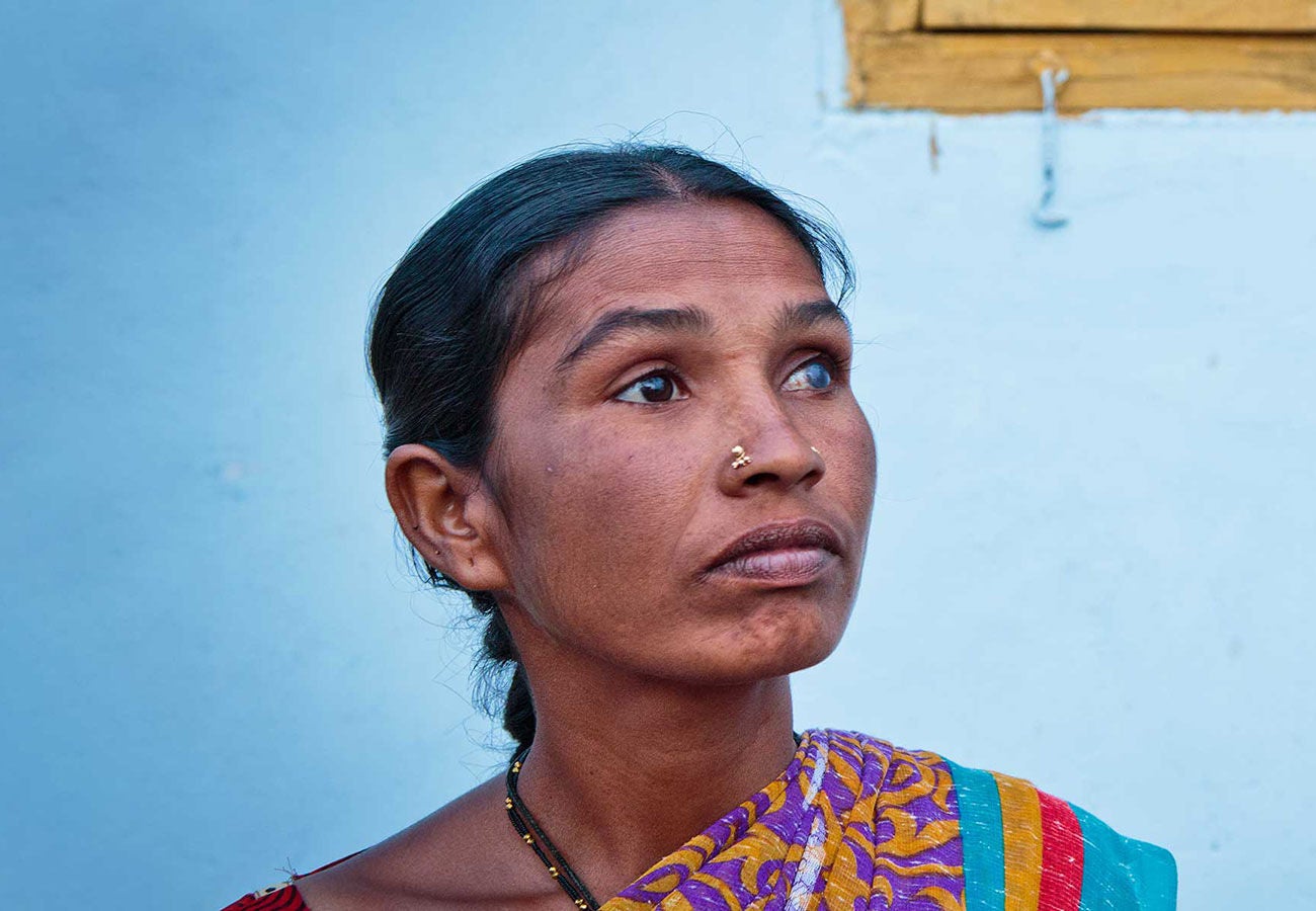 Portrait of a blind Indian woman.